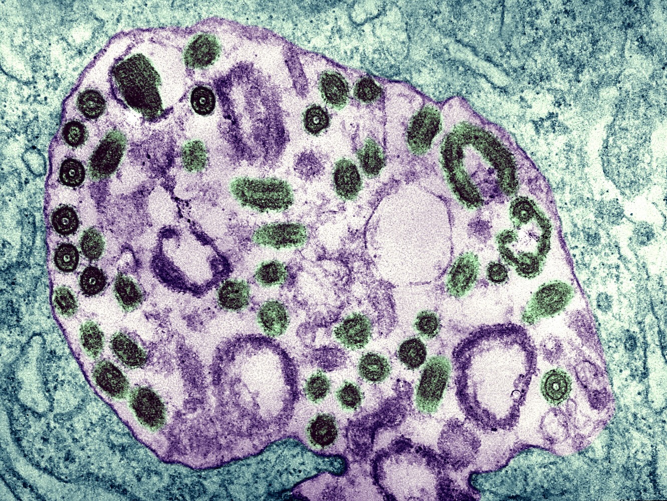 Color-enhanced microscopic image of the Marburg virus with green and purple viral particles.